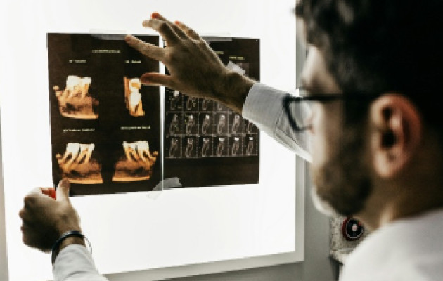 Medical professional looking at x-ray